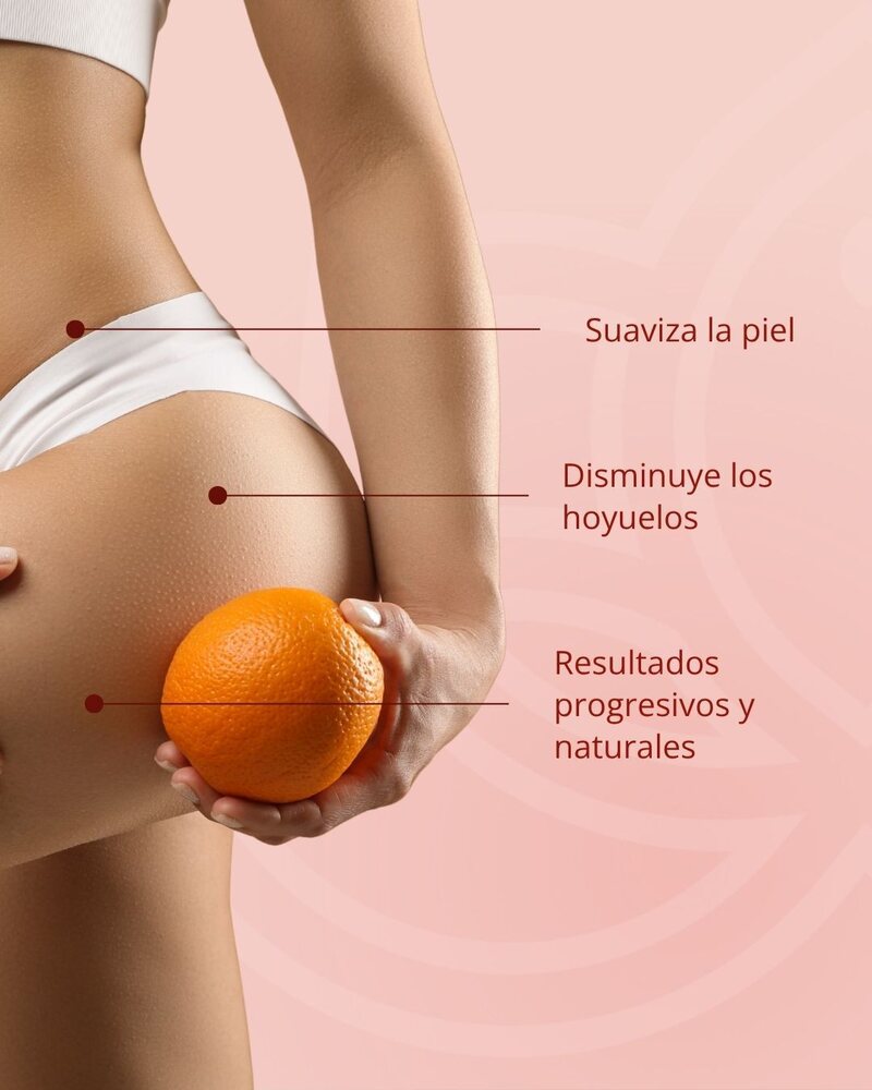 Beneficios de Alidya contra la celulitis — VIVE Medical Spa Cancún